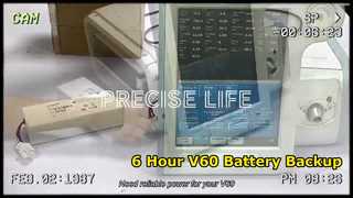 แบตเตอรี่เครื่องช่วยหายใจ Respironics V60 ใช้งานได้ 6 ชั่วโมง
